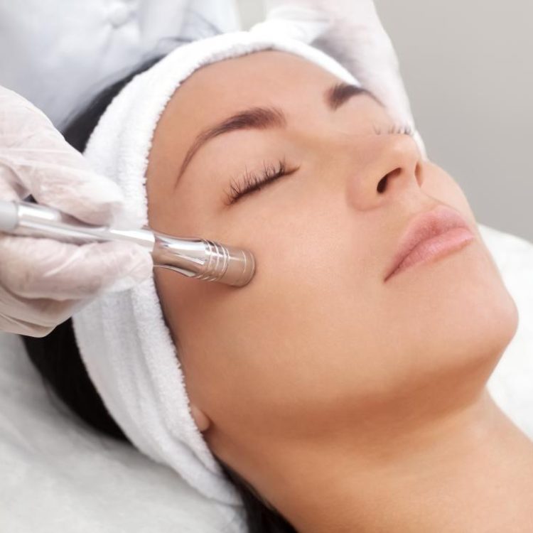 Microdermabrasion facial